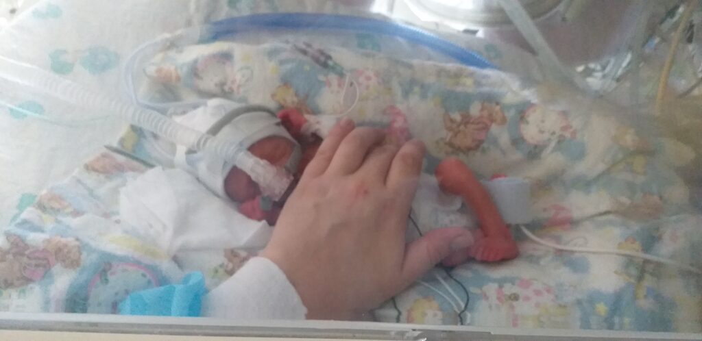 My First Experience of the NICU